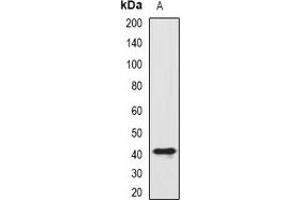 Western blot analysis of SIAT8D expression in HL60 (A) whole cell lysates.