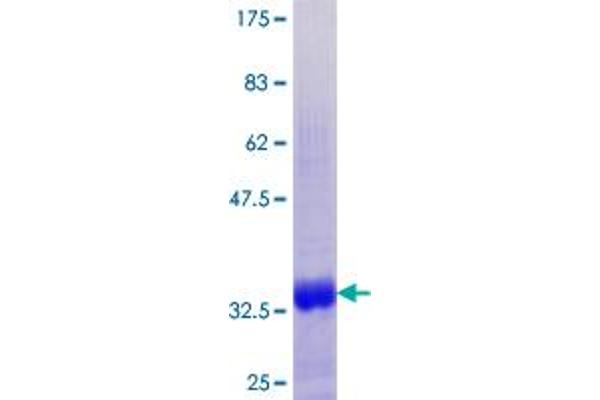 MT1G Protein (AA 1-61) (GST tag)