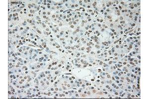 Immunohistochemical staining of paraffin-embedded pancreas tissue using anti-TNNI3mouse monoclonal antibody. (TNNI3 Antikörper  (AA 1-210))