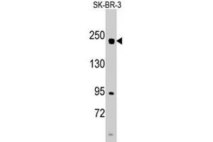 Western blot analysis of RICTOR polyclonal antibody  in SK-BR-3 cell line lysates (35 ug/lane). (RICTOR Antikörper  (N-Term))