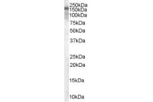 Image no. 1 for anti-Tuberous Sclerosis 1 (TSC1) (C-Term), (Isoform 1) antibody (ABIN374676) (TSC1 Antikörper  (C-Term, Isoform 1))