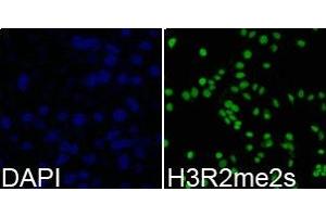 Immunofluorescence analysis of 293T cell using H3R2me2s antibody. (Histone 3 Antikörper  (H3R2me2s))