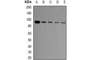 Western blot analysis of BCL11A expression in HT29 (A), Jurkat (B), Hela (C), A549 (D), mouse brain (E) whole cell lysates.