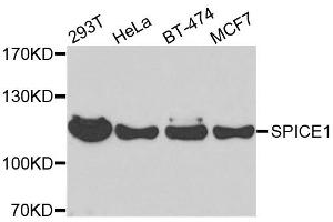 Western blot analysis of extracts of various cell lines, using SPICE1 antibody. (SPICE1 Antikörper  (AA 1-220))