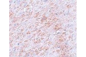 Immunohistochemistry (IHC) image for anti-Doublecortin-Like Kinase 2 (DCLK2) (C-Term) antibody (ABIN1030358) (DCLK2 Antikörper  (C-Term))