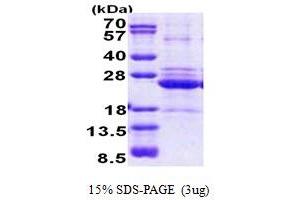 SDS-PAGE (SDS) image for HLA Class II DO alpha (HLA-DOA) (AA 26-217) protein (His tag) (ABIN5778626) (HLA-DOA Protein (AA 26-217) (His tag))