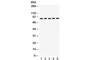 Western blot testing of 1) rat testis, 2) rat thymus, 3) human placenta, 4) SW620 and 5) HeLa lysate with HSP90 beta antibody. (HSP90AB1 Antikörper)