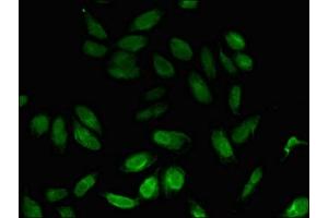 Immunofluorescent analysis of Hela cells using ABIN7160707 at dilution of 1: 100 and Alexa Fluor 488-congugated AffiniPure Goat Anti-Rabbit IgG(H+L) (NPL Antikörper  (AA 17-77))