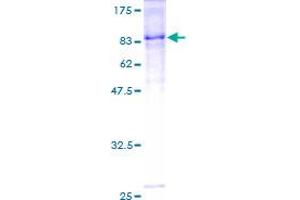 Image no. 1 for Intercellular Adhesion Molecule 1 (ICAM1) (AA 1-532) protein (GST tag) (ABIN1307324)