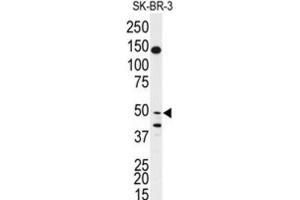 Western Blotting (WB) image for anti-BPI Fold Containing Family B, Member 2 (BPIFB2) antibody (ABIN3003205) (BPIL1 Antikörper)