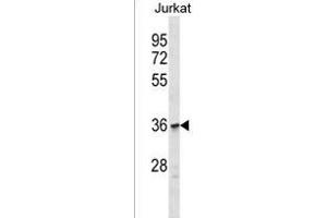 OR1C1 Antibody (C-term) (ABIN1537007 and ABIN2849909) western blot analysis in Jurkat cell line lysates (35 μg/lane). (OR1C1 Antikörper  (C-Term))