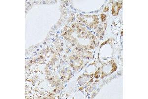 Immunohistochemistry (IHC) image for anti-Protein Phosphatase 2, Regulatory Subunit B', delta (PPP2R5D) (AA 450-550) antibody (ABIN7269690)