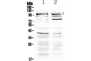 Western blot analysis of TRPC3 using anti-TRPC3 antibody . (TRPC3 Antikörper  (AA 718-770))