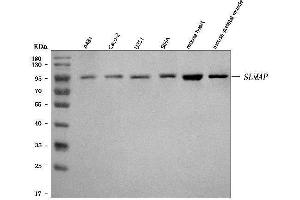 Western blot analysis of SLMAP using anti-SLMAP antibody (ABIN7600916).