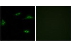Immunofluorescence analysis of LOVO cells, using OR2T11 Antibody. (OR2T11 Antikörper  (AA 51-100))