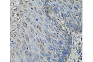 Immunohistochemistry of paraffin-embedded Human esophagus using IL1A Polyclonal Antibody at dilution of 1:100 (40x lens). (IL1A Antikörper)