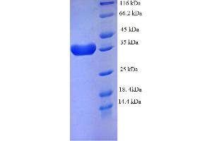 Eukaryotic Translation Initiation Factor 4E Binding Protein 2 (EIF4EBP2) (AA 1-120), (full length) protein (GST tag)