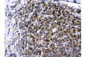 ARHGEF1 was detected in paraffin-embedded sections of rat lymphaden tissues using rabbit anti- ARHGEF1 Antigen Affinity purified polyclonal antibody (Catalog # ) at 1 µg/mL. (ARHGEF1 Antikörper  (N-Term))