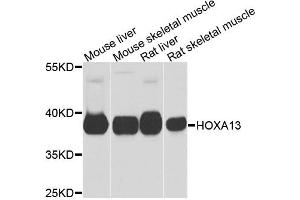 Western blot analysis of extracts of various cell lines, using HOXA13 antibody. (HOXA13 Antikörper)