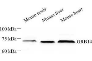 Western blot analysis of GRB14 (ABIN7074135) at dilution of 1: 500