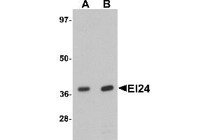 Western blot analysis of EI24 in rat liver tissue lysate with EI24 antibody at (A) 1 and (B) 2 µg/mL. (EI24 Antikörper  (C-Term))
