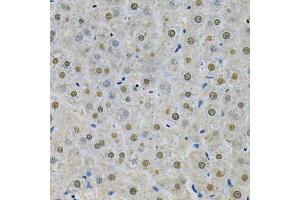Immunohistochemistry of paraffin-embedded rat liver using SPHK1 Antibody (ABIN5970017) at dilution of 1/200 (40x lens). (SPHK1 Antikörper)