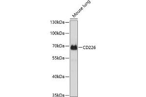 Western blot analysis of extracts of mouse lung, using CD226 antibody (ABIN6129948, ABIN6138145, ABIN6138147 and ABIN6214475) at 1:1000 dilution. (CD226 Antikörper  (AA 19-254))