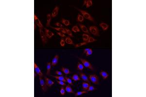 Immunofluorescence analysis of NIH/3T3 cells using PI3 Kinase p85 alpha antibody (ABIN6130617, ABIN6145642, ABIN6145645 and ABIN6215197) at dilution of 1:100. (PIK3R1 Antikörper  (AA 240-380))