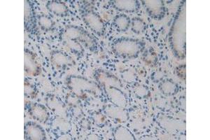 IHC-P analysis of Human Stomach Tissue, with DAB staining. (EBI3 Antikörper)