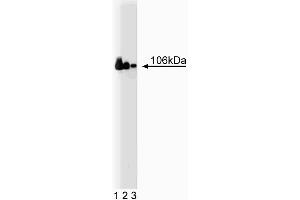 Western blot analysis of Adaptin beta on a Jurkat cell lysate (Human T-cell leukemia, ATCC TIB-152) (left).