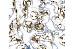 IHC analysis of CD31/PECAM1 using anti-CD31/PECAM1 antibody (ABIN7601076). (CD31 Antikörper  (AA 28-382))