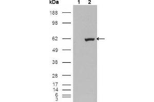 Western Blot showing using ETV1 antibody used against HEK293T cells transfected with the pCMV6-ENTRY control (1) and pCMV6-ENTRY ETV1 cDNA (2). (ETV1 Antikörper  (AA 1-191))