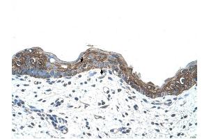 Ankyrin 1 antibody was used for immunohistochemistry at a concentration of 4-8 ug/ml to stain Squamous epithelial cells (arrows) in Human Skin. (Erythrocyte Ankyrin Antikörper  (C-Term))