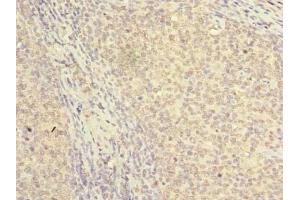 Immunohistochemistry of paraffin-embedded human tonsil tissue using ABIN7161534 at dilution of 1:100 (NKIRAS2 Antikörper  (AA 1-191))