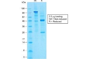 SDS-PAGE Analysis of Purified CA19-9 Rabbit Monoclonal Antibody (CA19. (CA 19-9 Antikörper)
