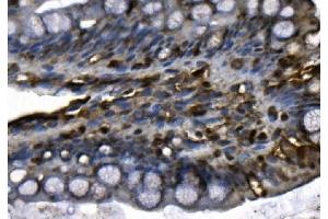 IHC analysis of MCM4 using anti-MCM4 antibody (ABIN7601485). (MCM4 Antikörper  (AA 361-677))
