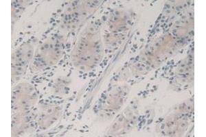 Detection of TGFb3 in Human Stomach Tissue using Monoclonal Antibody to Transforming Growth Factor Beta 3 (TGFb3) (TGFB3 Antikörper  (AA 24-300))