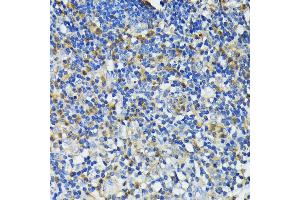 Immunohistochemistry of paraffin-embedded human appendix using CAMP antibody (ABIN7266146) at dilution of 1:200 (40x lens). (Cathelicidin Antikörper  (AA 31-170))