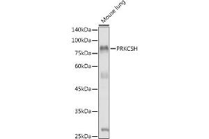 Western blot analysis of extracts of Mouse lung, using PRKCSH antibody (ABIN1682300, ABIN3018458 and ABIN7101614) at 1:1000 dilution.