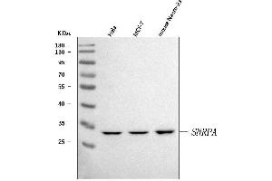 Western blot analysis of U1A/SNRPA using anti-U1A/SNRPA antibody (ABIN7600891). (SNRPA1 Antikörper  (AA 25-218))