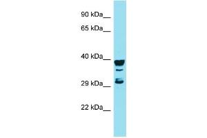 Host: Rabbit Target Name: RGS7BP Sample Type: MCF7 Whole Cell lysates Antibody Dilution: 1. (RGS7BP Antikörper  (Middle Region))