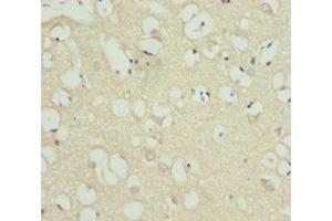 Immunohistochemistry of paraffin-embedded human brain tissue using ABIN7158523 at dilution of 1:100 (ACSL6 Antikörper  (AA 458-697))