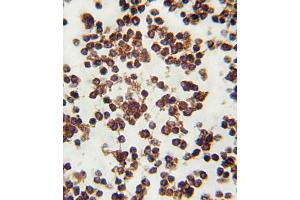 Formalin-fixed and paraffin-embedded human lymph tissue reacted with ALOX15 antibody (C-term), which was peroxidase-conjugated to the secondary antibody, followed by DAB staining. (ALOX15 Antikörper  (C-Term))