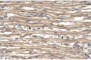 Immunohistochemical staining (Formalin-fixed paraffin-embedded sections) of human muscle with ACTR2 polyclonal antibody  at 4-8 ug/mL working concentration. (ACTR2 Antikörper  (N-Term))