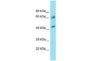 Western Blotting (WB) image for anti-Family with Sequence Similarity 83, Member A (FAM83A) (C-Term) antibody (ABIN2791509)