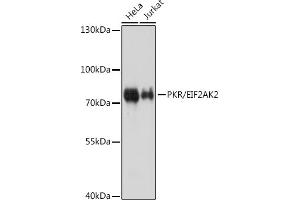 Western blot analysis of extracts of various cell lines, using PKR/PKR/EIF2 antibody (ABIN1679688 and ABIN3018462) at 1:1000 dilution. (EIF2AK2 Antikörper)