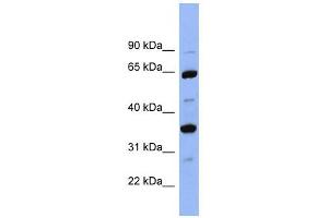 SERPINC1 antibody used at 1 ug/ml to detect target protein. (SERPINC1 Antikörper)