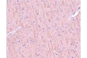 Immunohistochemistry of rat brain tissue with CCDC106 polyclonal antibody  at 5 ug/mL.