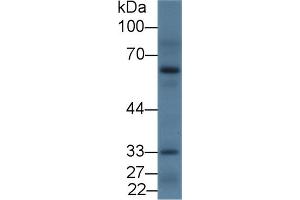 Detection of DRD2 in Rat Cerebrum lysate using Polyclonal Antibody to Dopamine Receptor D2 (DRD2) (Dopamine d2 Receptor Antikörper  (AA 194-421))