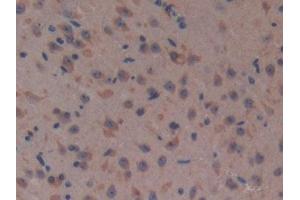Detection of CFH in Mouse Brain Tissue using Polyclonal Antibody to Complement Factor H (CFH)